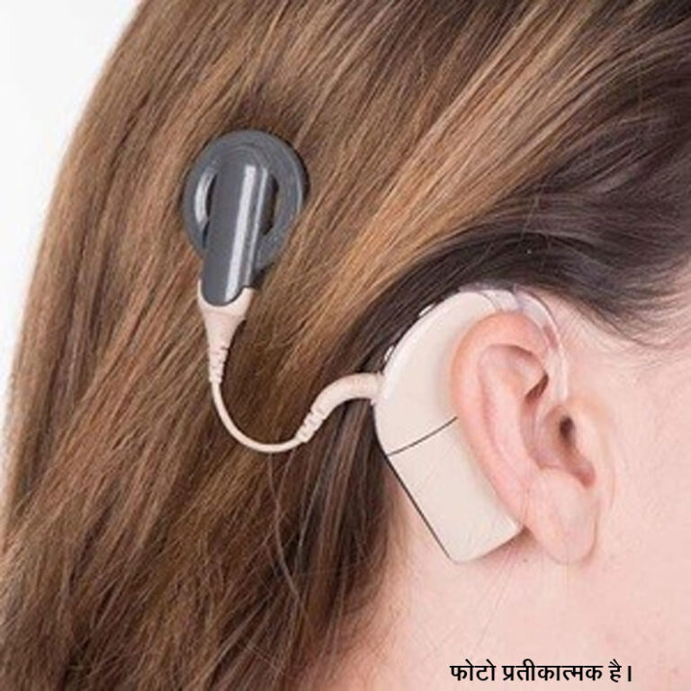 पश्चिम राजस्थान में चिकित्सा का नया अध्याय: मेड़ता निवासी को मिली सुनने की शक्ति, कॉक्लियर इम्प्लांट सर्जरी बनी वरदान